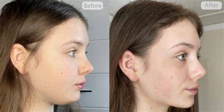 Unveiling Before And After Secrets